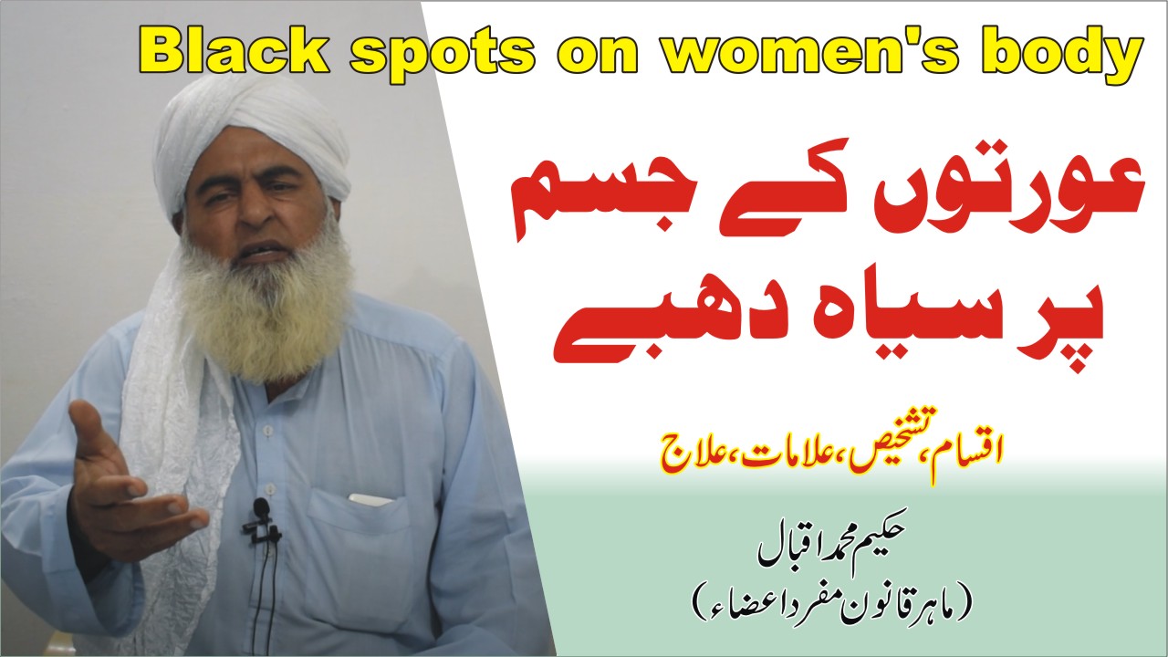 عورتوں کے جسم پر سیاہ دھبے