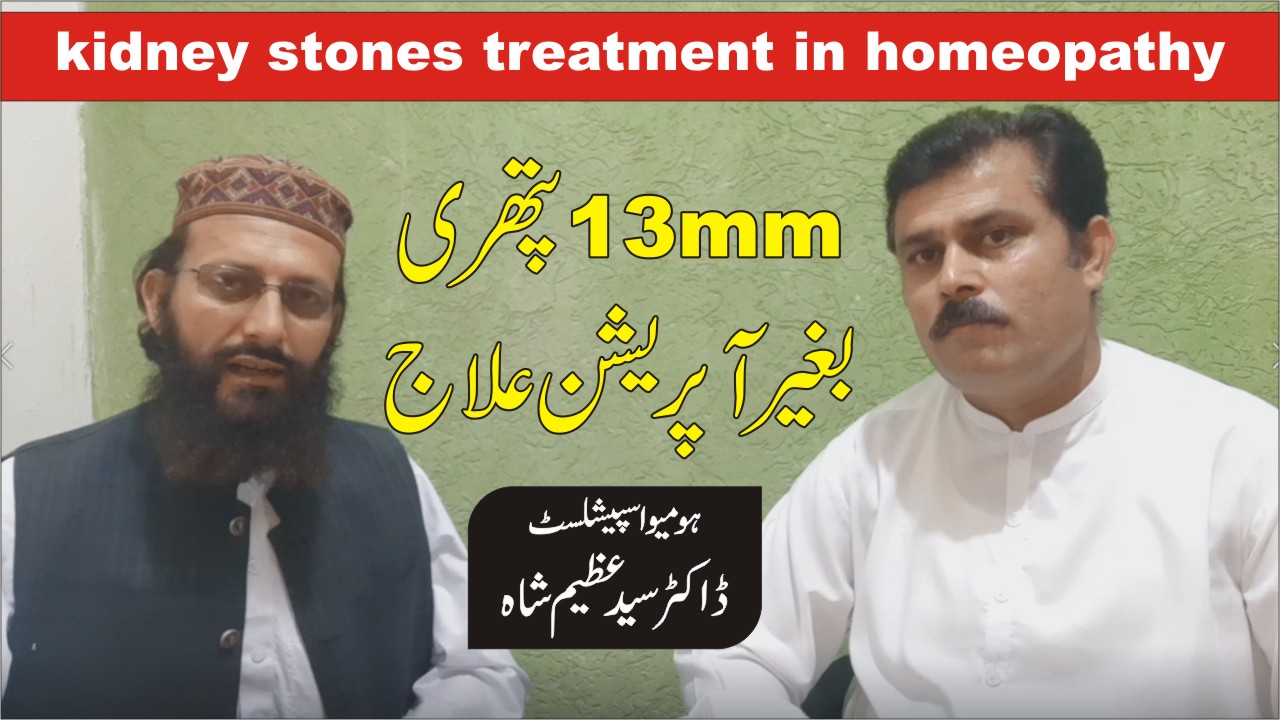 گردے کی پتھری ہومیوپیتھی میں علاج
