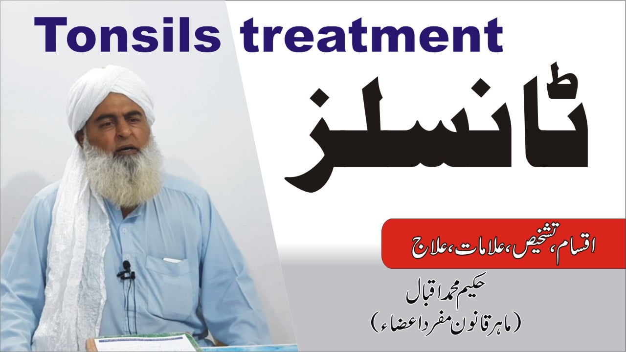 tonsils treatment टॉन्सिल 1