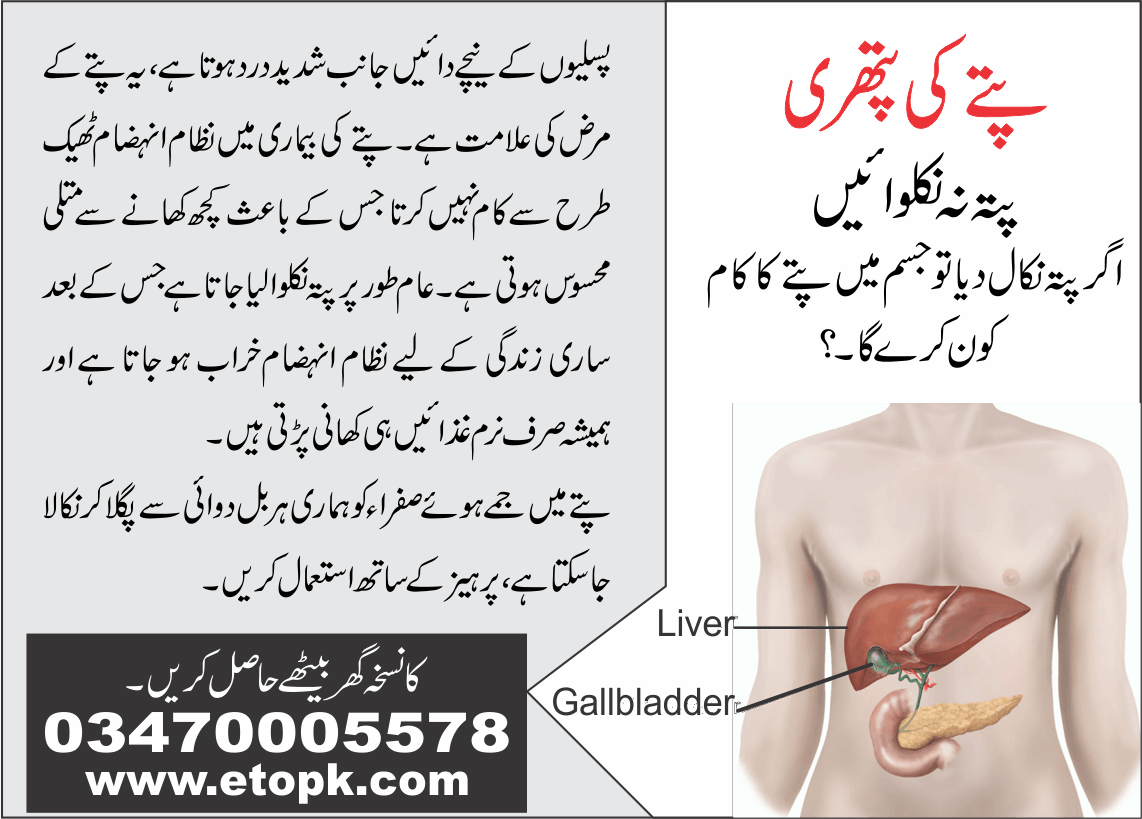 gallbladder stone پتے کی پتھری